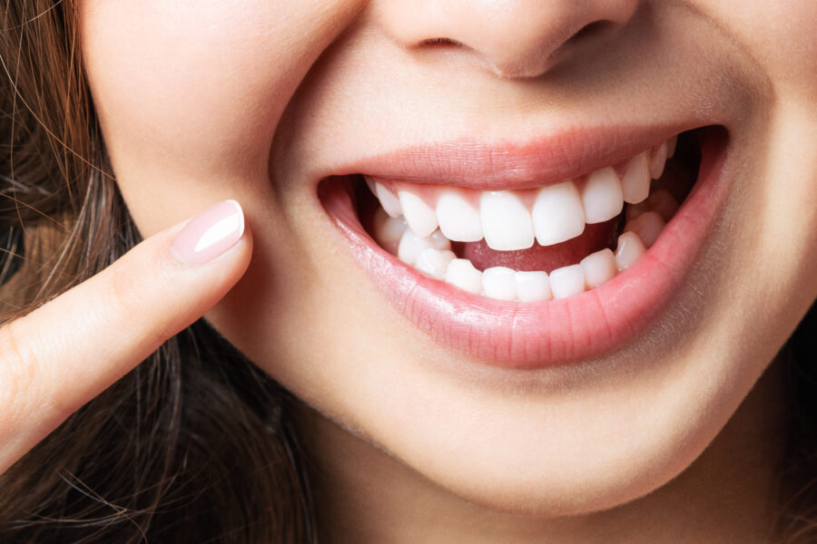 Service for cosmetic dental makeovers