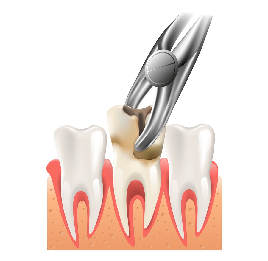 Dental Check-ups