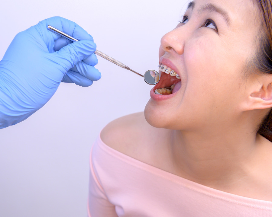Dental Check-ups
