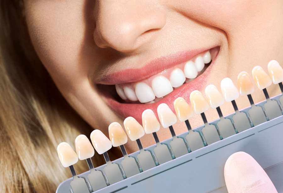 Zoom Teeth Whitening