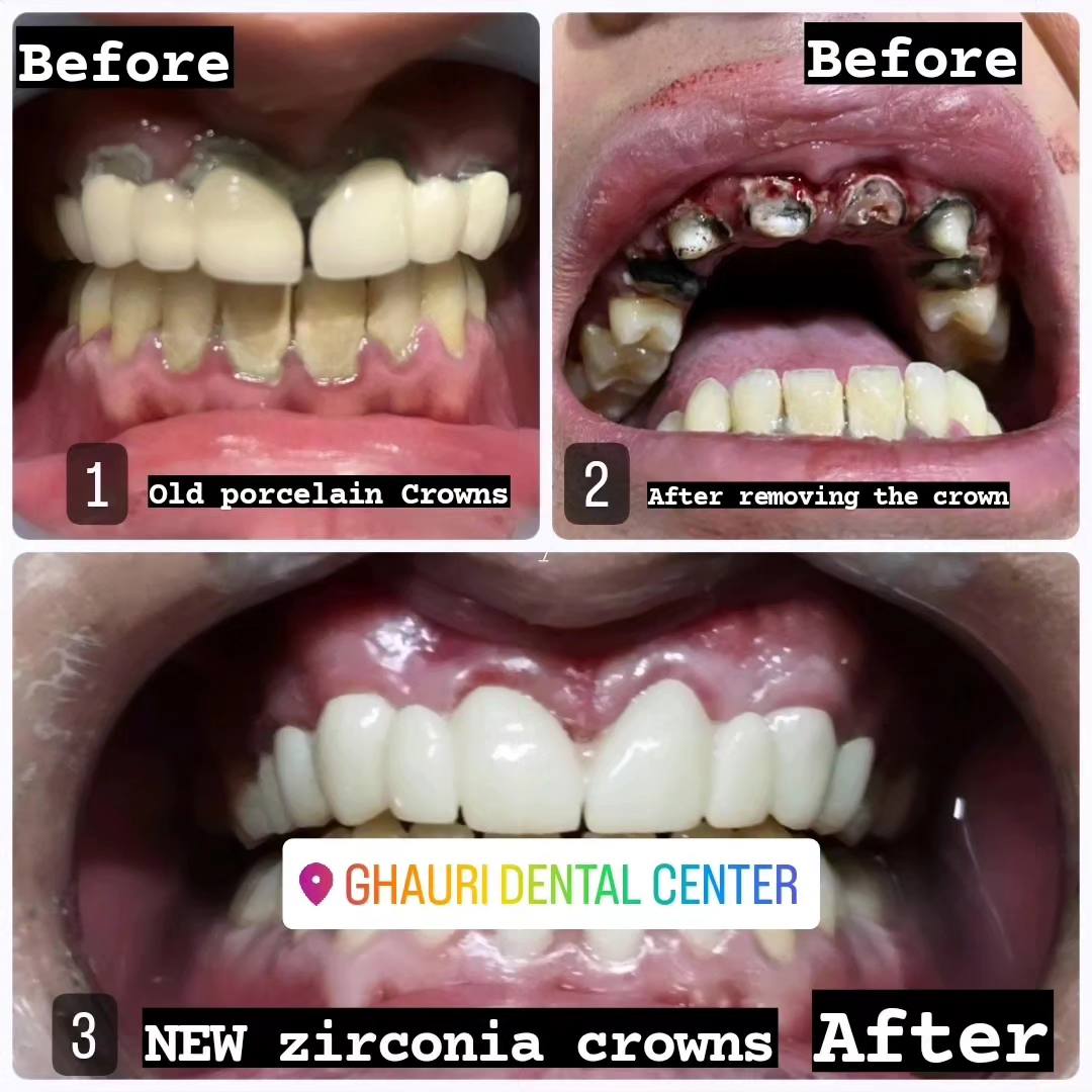 ghauri_dental