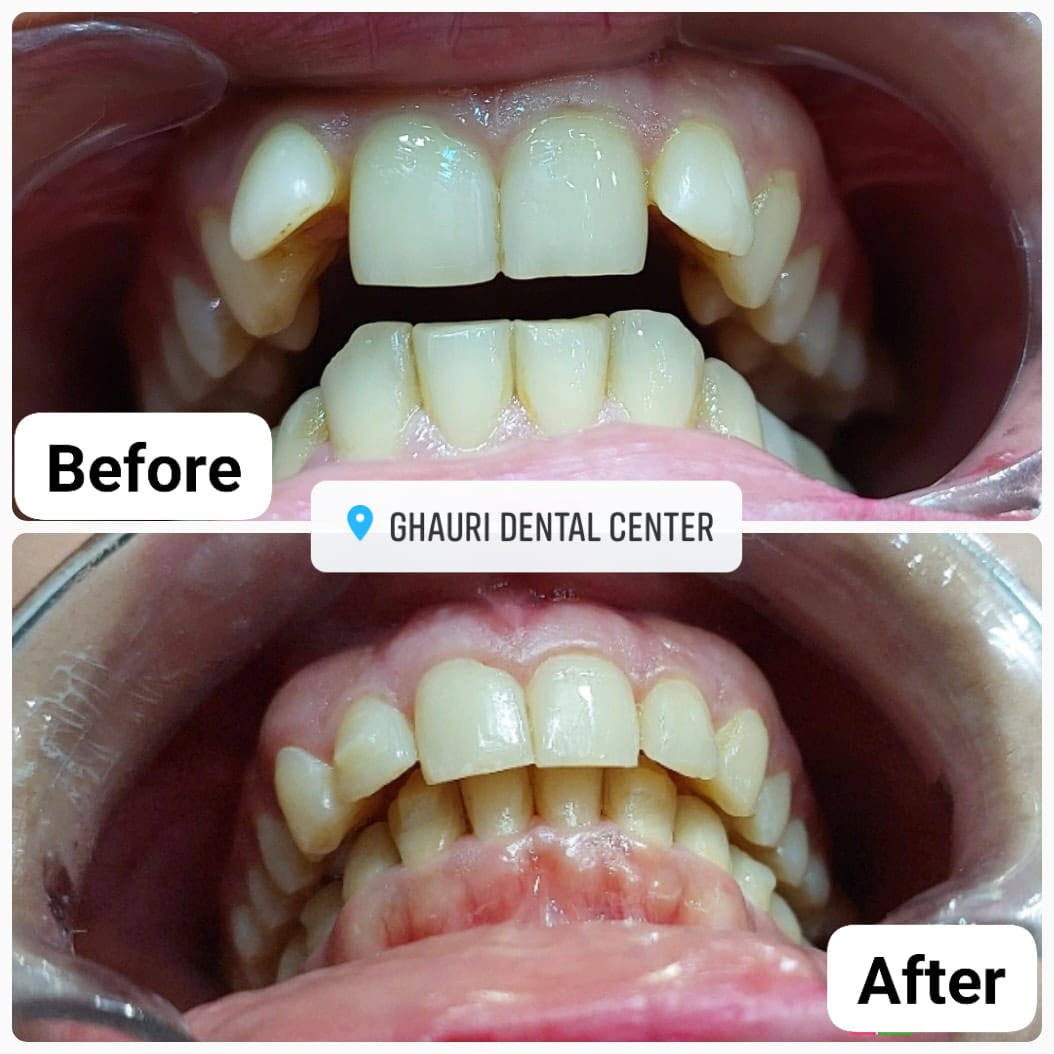 ghauri_dental