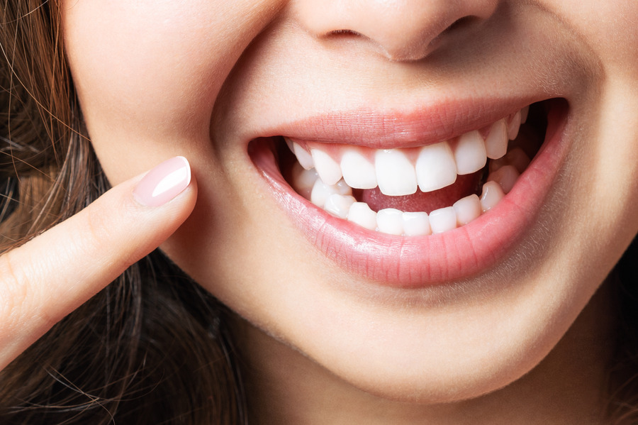 Dental Care
